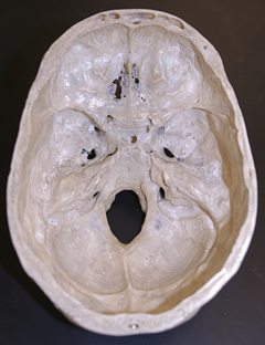 Skull Inner Surface